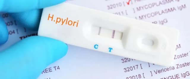 NFZ nie refunduje badania helicobacter pylori z krwi – co wybrać?